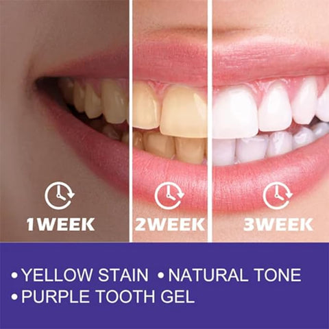 Purple Corrector Toothpaste – Brighten Your Smile Instantly!