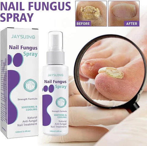 Fungus Nail Treatment Spray – Restore Healthy Nails Fast!